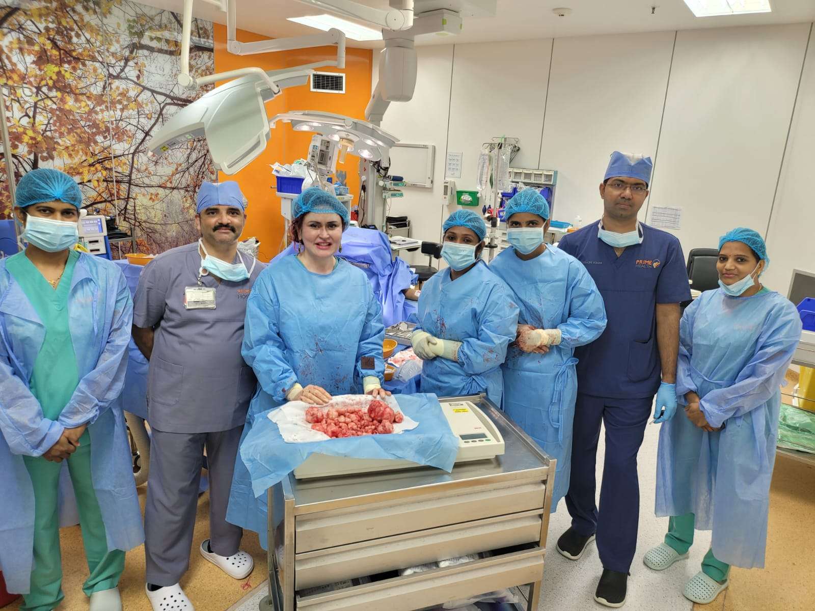 Consultant Gynaecologist at Prime Hospital removes 168 fibroids from a woman's uterus saving her uterus.